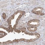 PDE11A Antibody in Immunohistochemistry (Paraffin) (IHC (P))