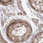 PDE11A Antibody in Immunohistochemistry (Paraffin) (IHC (P))