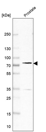 PDE11A Antibody in Western Blot (WB)