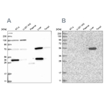 UGP2 Antibody in Western Blot (WB)