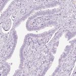 VCAM-1 Antibody in Immunohistochemistry (Paraffin) (IHC (P))