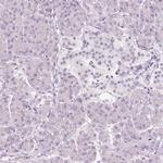 VCAM-1 Antibody in Immunohistochemistry (Paraffin) (IHC (P))