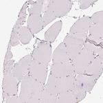 VCAM-1 Antibody in Immunohistochemistry (Paraffin) (IHC (P))