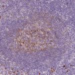 VCAM-1 Antibody in Immunohistochemistry (Paraffin) (IHC (P))