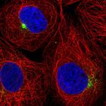 SLC1A4 Polyclonal Antibody