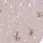 SLC1A4 Antibody in Immunohistochemistry (Paraffin) (IHC (P))