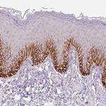 SLC1A4 Antibody in Immunohistochemistry (Paraffin) (IHC (P))