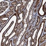 ATP2C1 Polyclonal Antibody