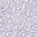 IKAROS Antibody in Immunohistochemistry (Paraffin) (IHC (P))