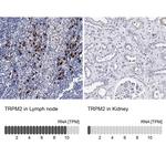 TRPM2 Polyclonal Antibody