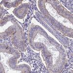CD99 Antibody in Immunohistochemistry (Paraffin) (IHC (P))