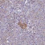 CD99 Antibody in Immunohistochemistry (Paraffin) (IHC (P))