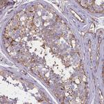 CD99 Antibody in Immunohistochemistry (Paraffin) (IHC (P))