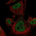 MEKK3 Polyclonal Antibody