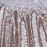 TREX1 Antibody in Immunohistochemistry (Paraffin) (IHC (P))