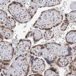 TREX1 Antibody in Immunohistochemistry (Paraffin) (IHC (P))