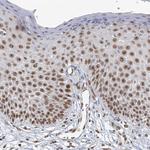 TREX1 Antibody in Immunohistochemistry (Paraffin) (IHC (P))