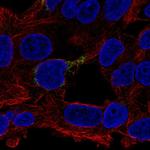 ECHDC1 Polyclonal Antibody