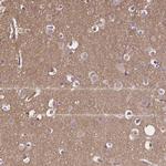 CRMP1 Antibody in Immunohistochemistry (Paraffin) (IHC (P))
