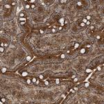 TRIP Antibody in Immunohistochemistry (Paraffin) (IHC (P))