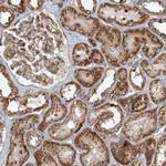 TRIP Antibody in Immunohistochemistry (Paraffin) (IHC (P))