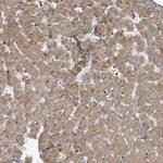 TRIP Antibody in Immunohistochemistry (Paraffin) (IHC (P))