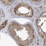 TRIP Antibody in Immunohistochemistry (Paraffin) (IHC (P))
