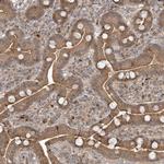 TRIP Antibody in Immunohistochemistry (Paraffin) (IHC (P))