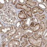 TRIP Antibody in Immunohistochemistry (Paraffin) (IHC (P))