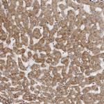 TRIP Antibody in Immunohistochemistry (Paraffin) (IHC (P))