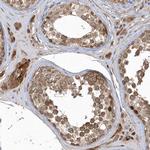 TRIP Antibody in Immunohistochemistry (Paraffin) (IHC (P))