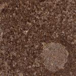 ALS2CR1 Polyclonal Antibody