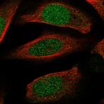 ECT2 Antibody in Immunocytochemistry (ICC/IF)
