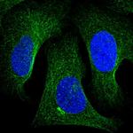 Tankyrase 2 Polyclonal Antibody