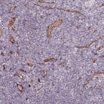CD34 Antibody in Immunohistochemistry (Paraffin) (IHC (P))