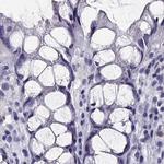CRX Antibody in Immunohistochemistry (Paraffin) (IHC (P))