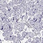 CRX Antibody in Immunohistochemistry (Paraffin) (IHC (P))