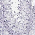 CRX Antibody in Immunohistochemistry (Paraffin) (IHC (P))