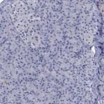 GLAST Antibody in Immunohistochemistry (Paraffin) (IHC (P))