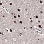 SR140 Antibody in Immunohistochemistry (Paraffin) (IHC (P))