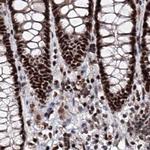 SR140 Antibody in Immunohistochemistry (Paraffin) (IHC (P))