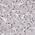 SR140 Antibody in Immunohistochemistry (Paraffin) (IHC (P))
