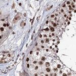 SR140 Antibody in Immunohistochemistry (Paraffin) (IHC (P))