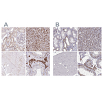 CLN2 Polyclonal Antibody
