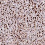 CLN2 Antibody in Immunohistochemistry (Paraffin) (IHC (P))