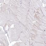 CLN2 Antibody in Immunohistochemistry (Paraffin) (IHC (P))