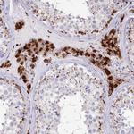 CLN2 Antibody in Immunohistochemistry (Paraffin) (IHC (P))