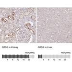 Arylsulfatase B Polyclonal Antibody