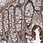 RICTOR Polyclonal Antibody