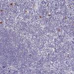 TNIP1 Polyclonal Antibody